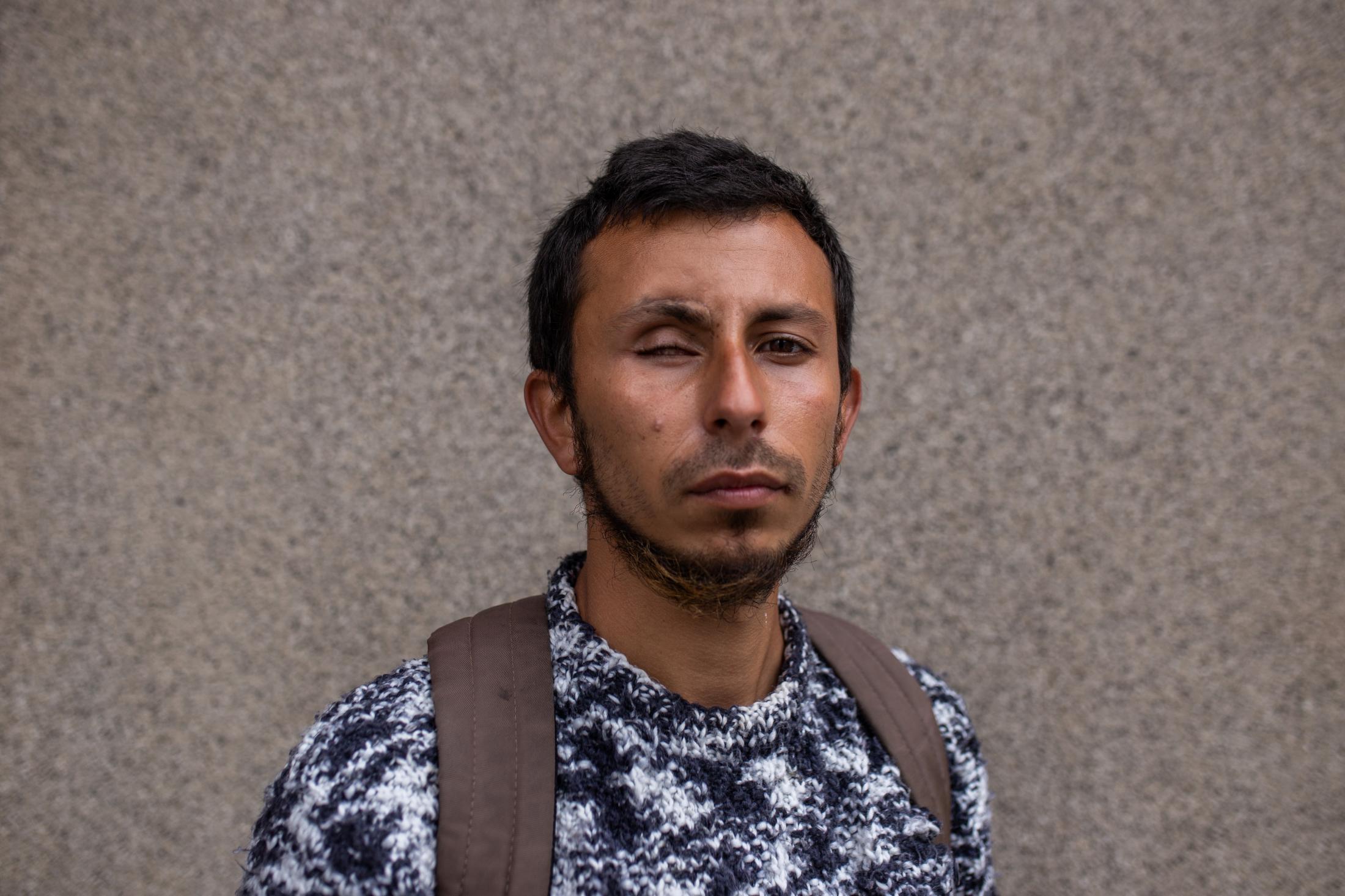 October 16, 2020. Mat&iacute;as Orellana, a victim of eye trauma, poses for a portrait during a protest to demand justice for his assault. Mat&iacute;as lost his right eye in the early morning of January 1, 2020 in Valpara&iacute;so due to a tear gas shot by the Carabineros, also causing a fracture to his skull. He is one of the more than 400 victims of eye trauma and has not yet found justice or reparation for his attack. Valparaiso, Chile