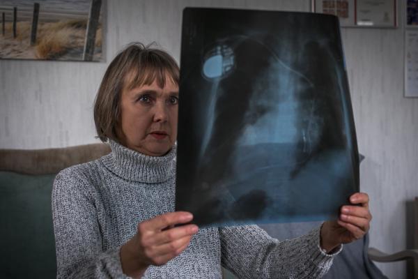 Image from AIR POLLUTION- for NRC - Aleksandr Bedek looks at an x-ray of her mother, who died...