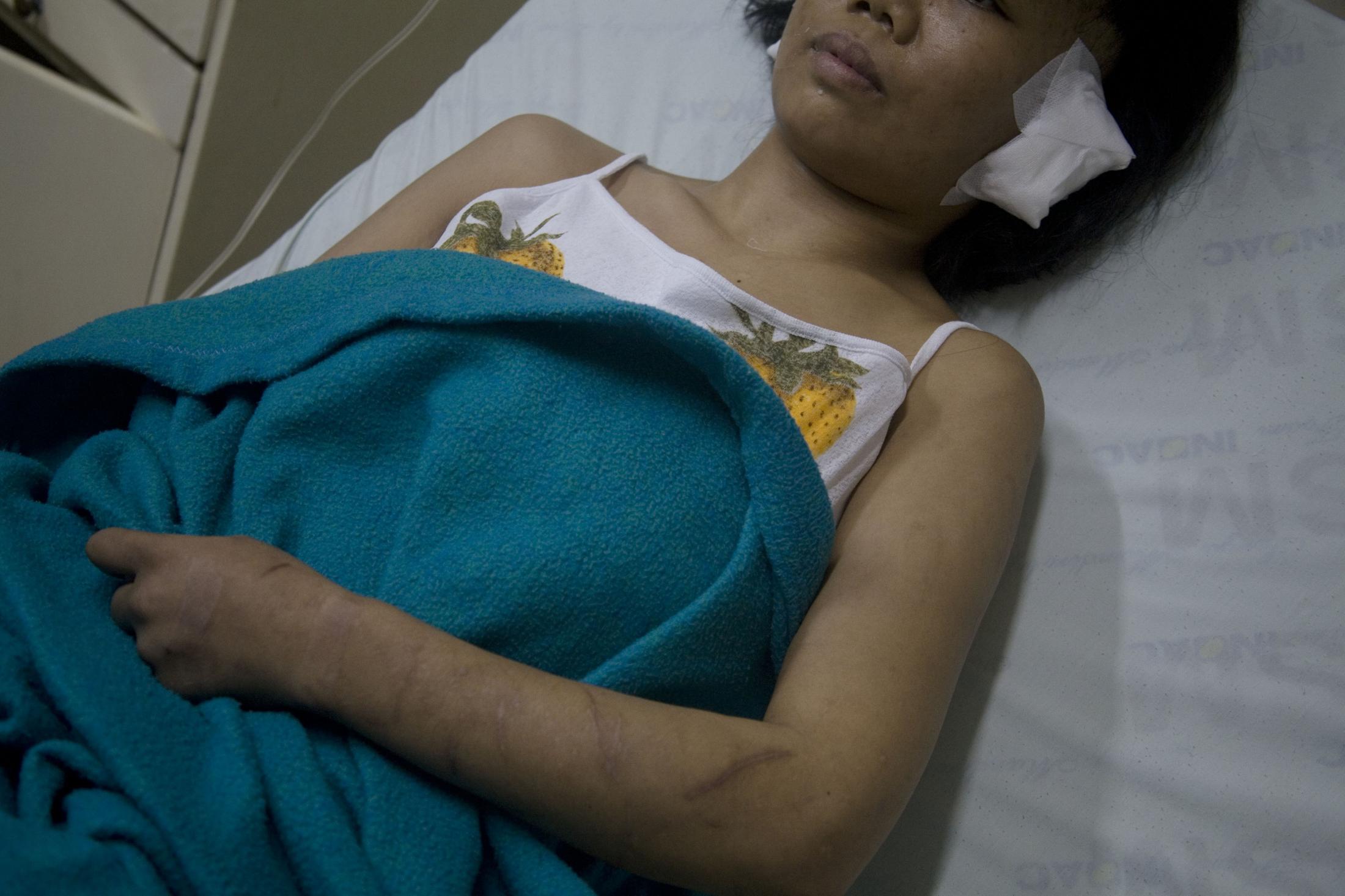 Sri (not her real name), 27, whose employer in the Middle East abused her, recovers at a hospital...