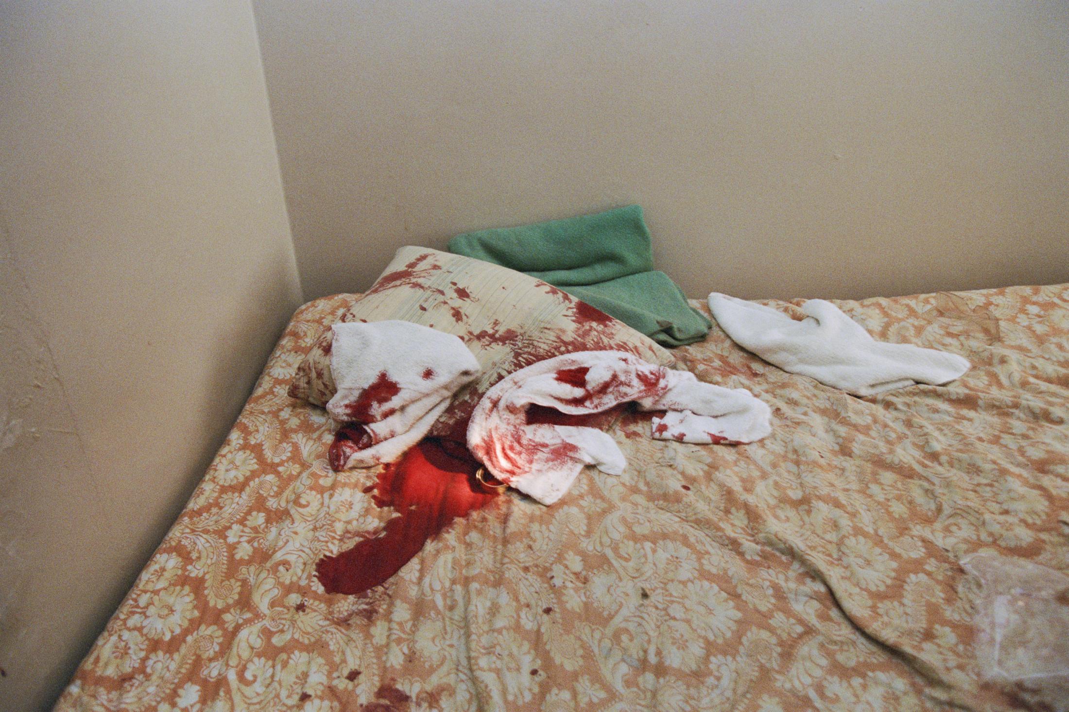 Archives of Abuse - Aftermath in hotel. San Francisco, 1991.
