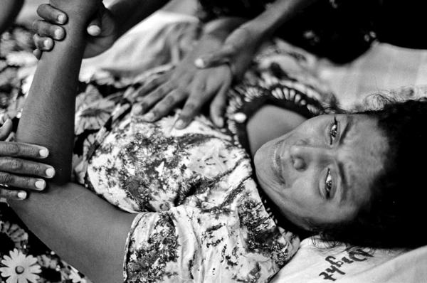 Sri Lanka Unrest - Tamil woman who was injured by a claymore mine explosion...