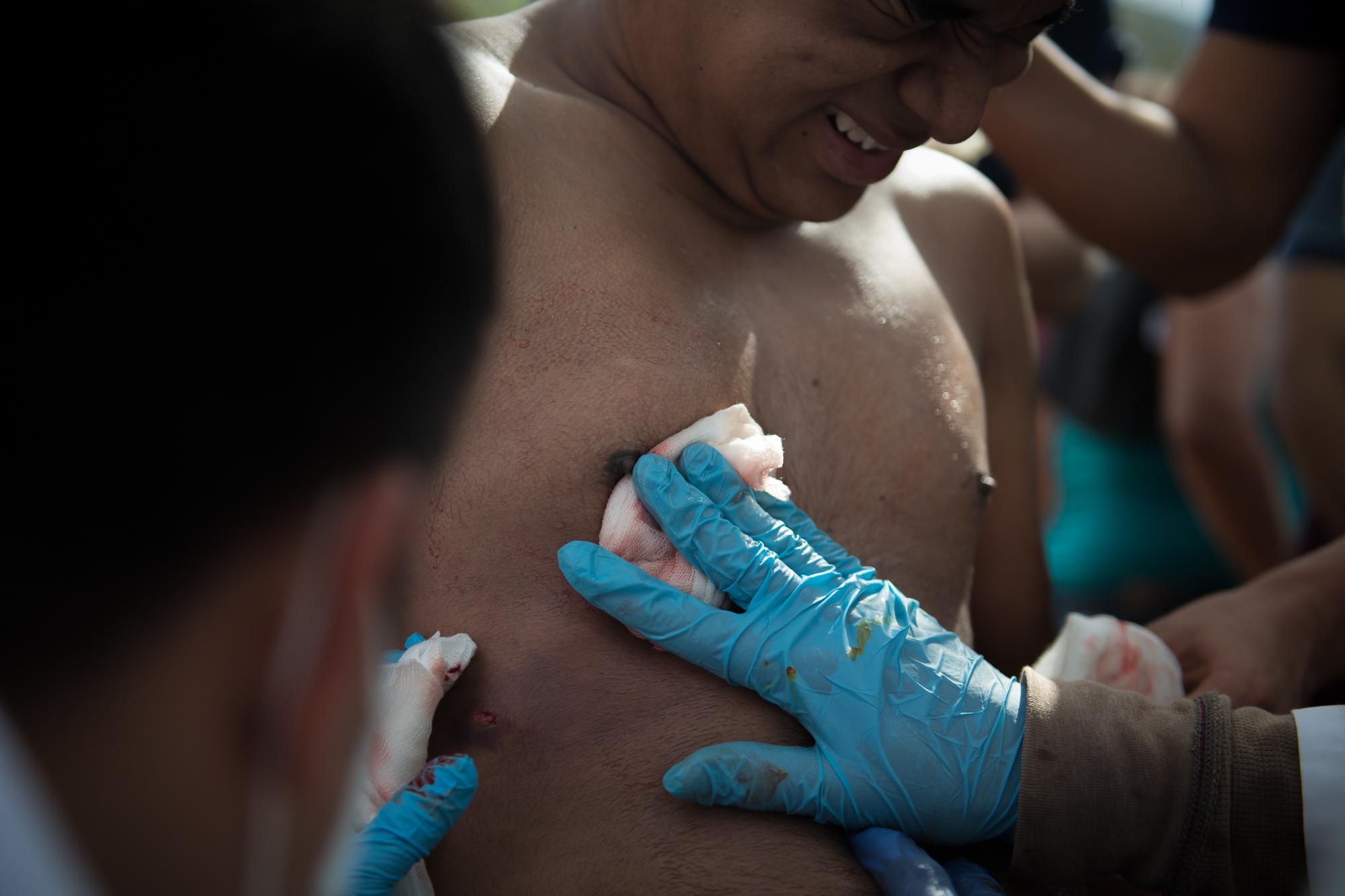A student is treated for shotgun shell wounds outside the cathedral in Managua following clashes with police. Un estudiante recibe tratamiento por...