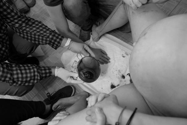 URBAN MIDWIVES - The midwives show Maria the head of her baby to give her strength and to be able to continue...