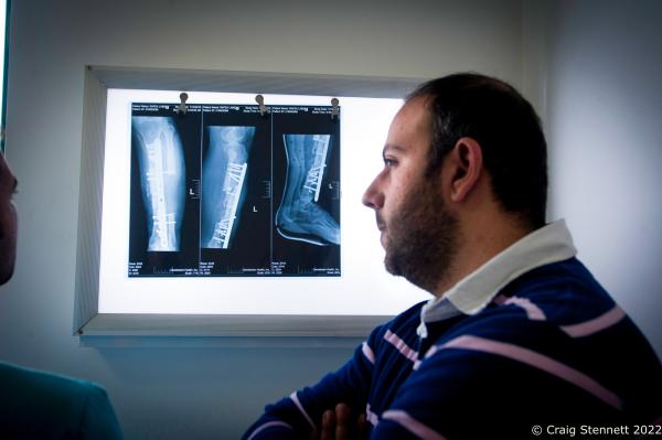 AMMAN, JORDAN-JANUARY 13: Orthopedic Surgeon Hanna Janho takes a look at a patients X-ray while in consultation with his fellow surgeon at MSF&#39;s (M&eacute;decins Sans Fronti&egrave;res/Doctors Without Borders) Hospital for Reconstructive Surgery in Amman, Jordan on January 13th, 2016. MSF opened the Al Mowasah Hospital in Tirmizi Street, Amman on the 8th September 2015. It is the first fully-fledged medical facility devoted solely to reconstructive surgery, physiotherapy and psychological support for victims of war. The Hospital is unique in offering a comprehensive care package free for its patients. It is the societies biggest single annual financial commitment with an expense of approximately &pound;7.5 million per year (2016) and a departure from its classical solely disaster response role towards one that offers &quot;rebuilding lives&quot;. (Photo by Craig Stennett/Getty Images)