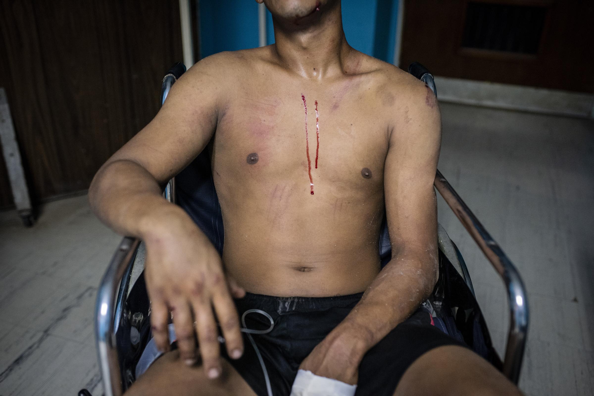 Venezuela / Between violence and justice